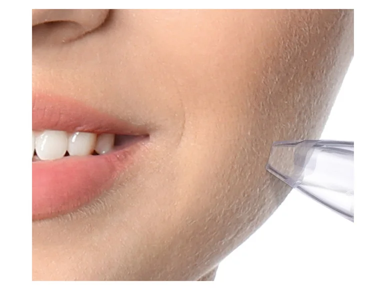 Nettoyeur de pores SPR 600 A1 - Image 6