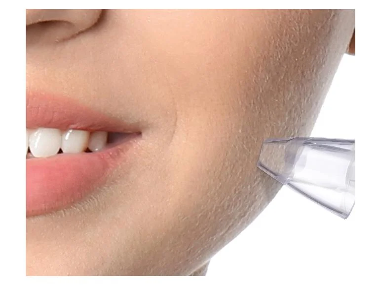 Nettoyeur de pores SPR 600 B1 - Image 4